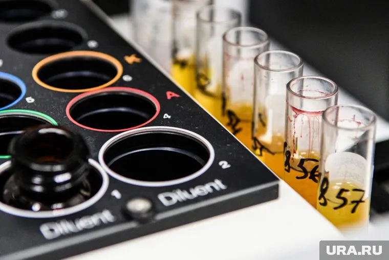 Тест на коронавирус подтвердился еще у четверых ямальцев