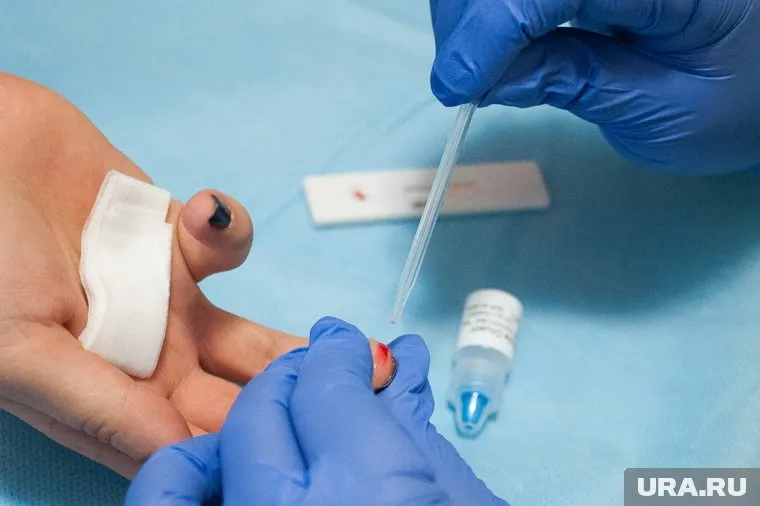 Исследования на ВИЧ проводятся с целью исключить риск заражения, например, перед хирургическими операциями