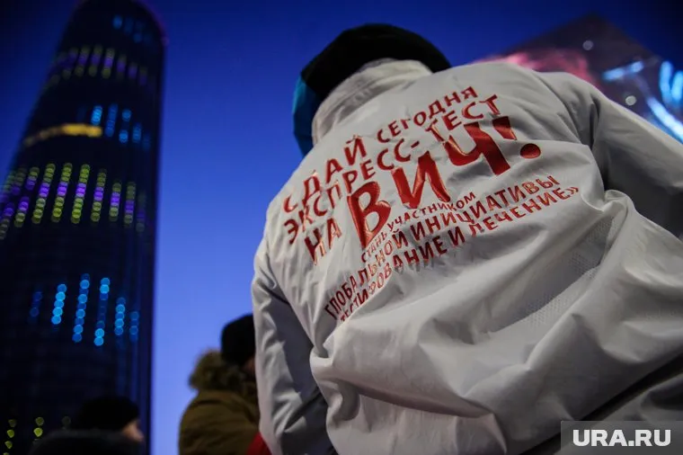 На первой стадии ВИЧ-инфекции у человека могут быть симптомы интоксикации