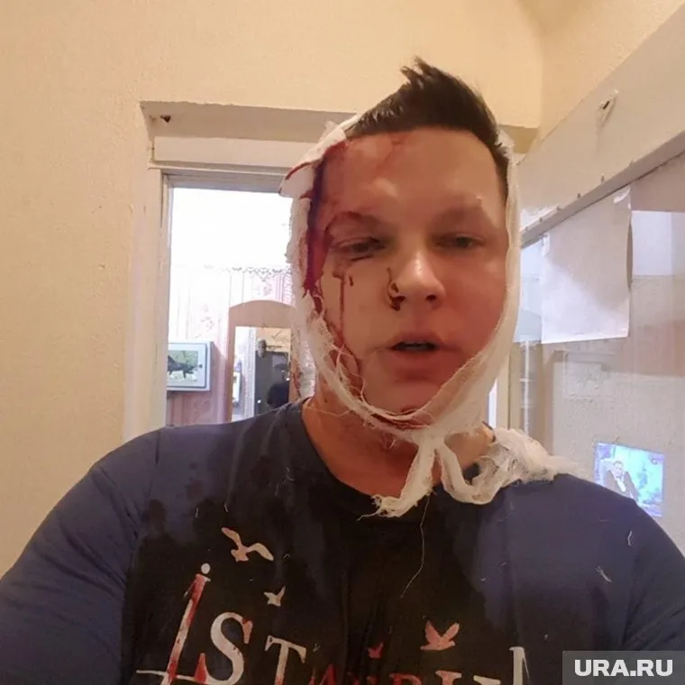 Помощника депутата подкараулили возле работы