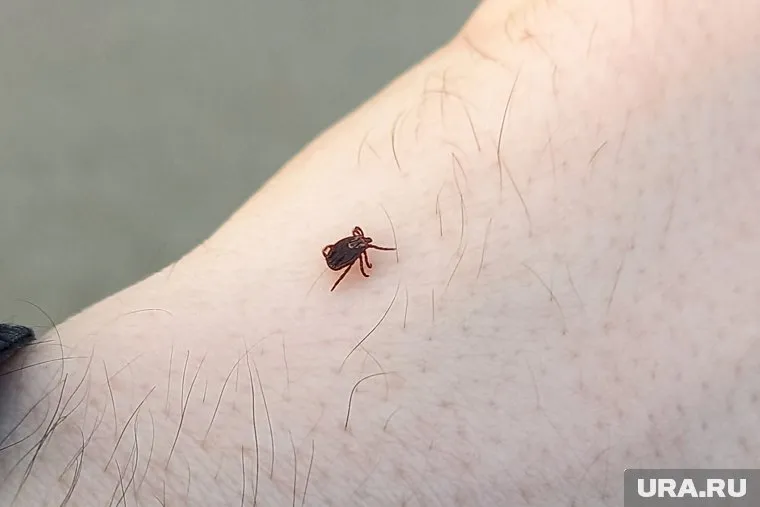 В первые сутки после укуса клеща необходимо провести экстренную профилактику клещевых инфекций