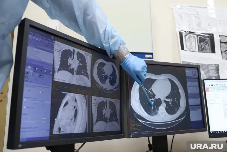 Легкие после COVID-19 могут постареть на 25-50%