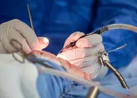 «Осколки вошли в мозг»: мальчика, выпавшего с 8 этажа в Екатеринбурге, оперировали 11 часов