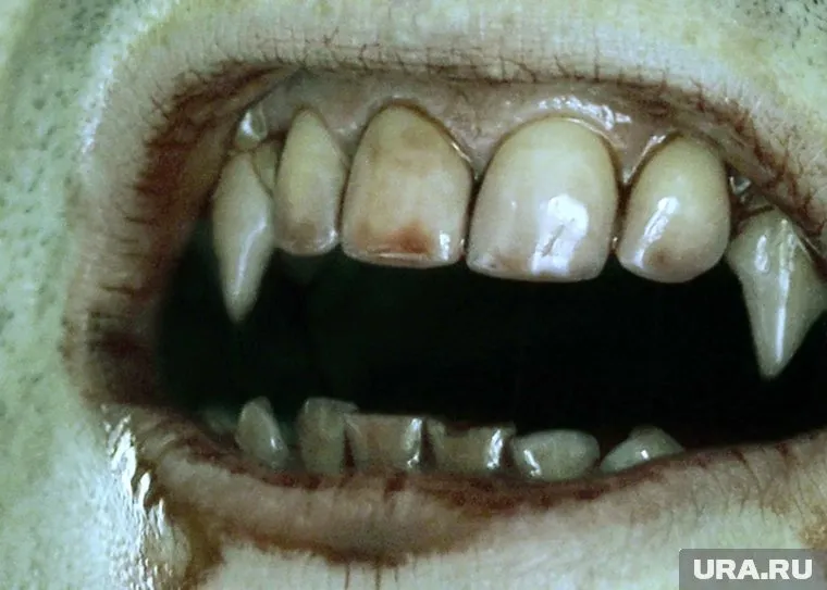 Зубастый дебошир пойдет под суд за «мелкое хулиганство»