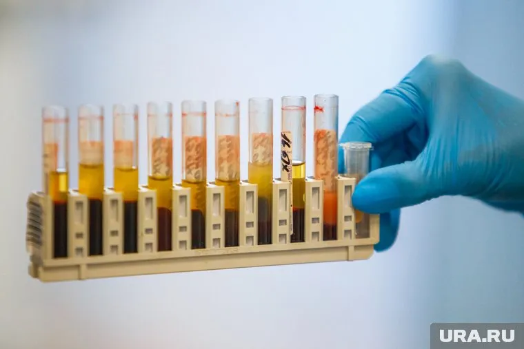 Эксперты заявили об эпидемии ВИЧ