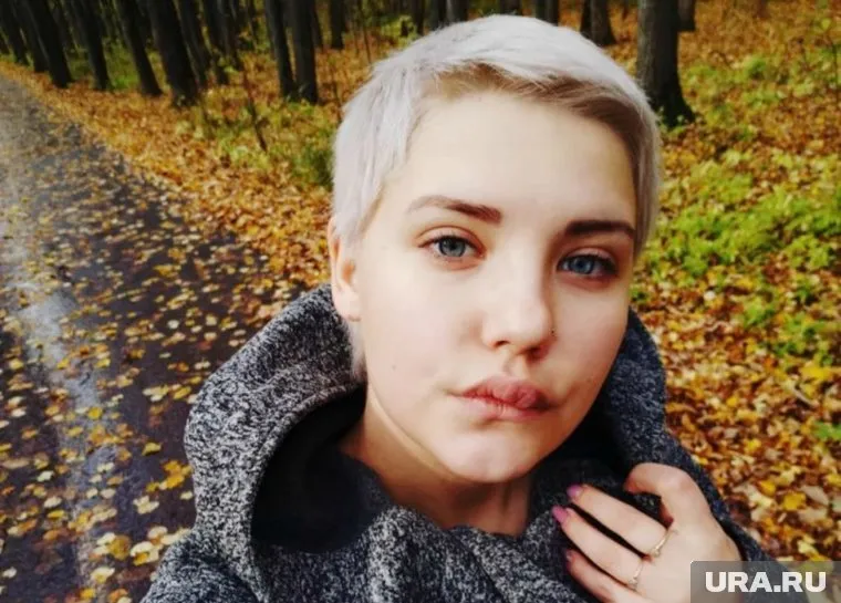 У Яны Тюменевой ангиовенозная дисплазия верхней губы