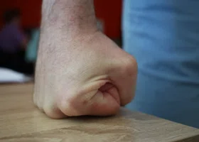 После драки со знакомым жительница ЯНАО впала в кому и скончалась