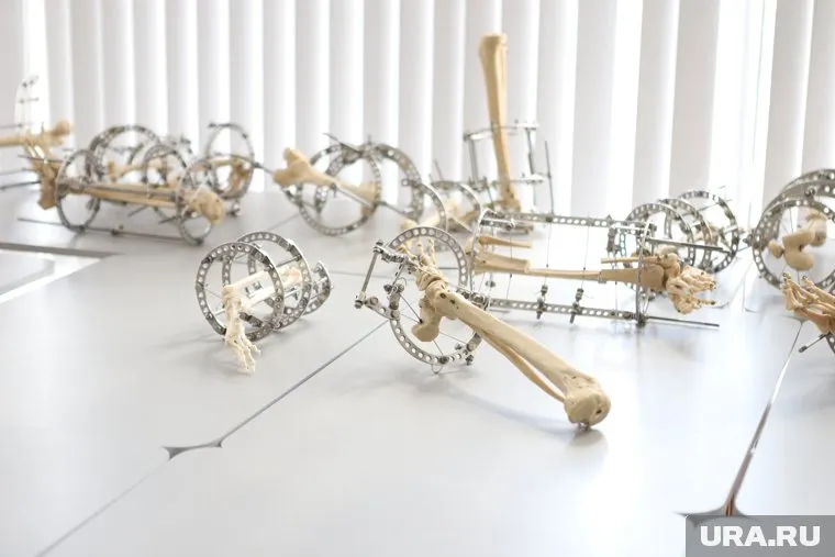 В Кургане запустят импортозамещающее производство титановых пластин для Центра Илизарова (архивное фото)