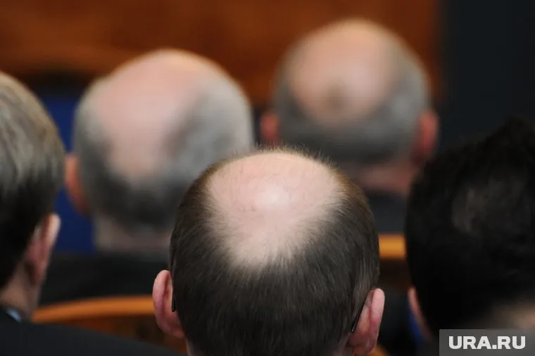 При алопеции снижается защита от сердечно-сосудистых заболеваний