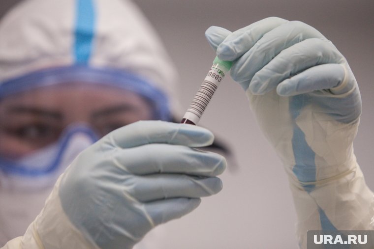 В Курганской области зарегистрировали новые случаи кори