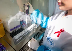 В Курганской области снизилась заболеваемость ВИЧ на 10%