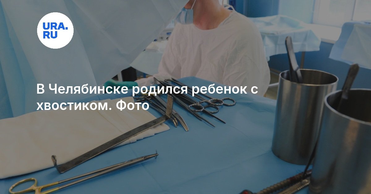 В Челябинске родился ребенок с хвостиком. Фото