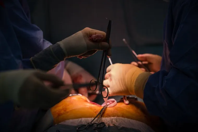 Хирургическая операция в Окружном кардиологическом диспансере «Центр диагностики и сердечно-сосудистой хирургии». Сургут