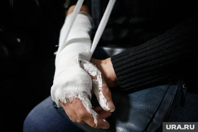 Пермячка повредила руку, сообщили в минтербезе (архивное фото)