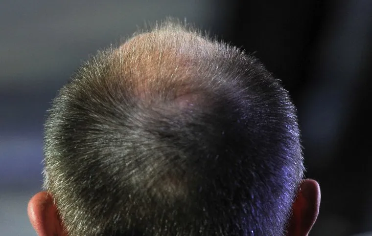 Операция по ликвидации участка облысения длилась несколько часов