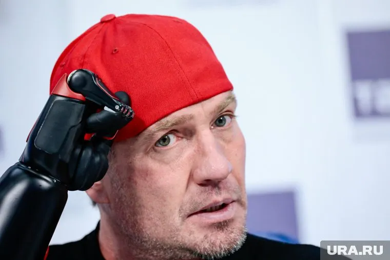 Костомаров рассказал о своей жизни с протезами