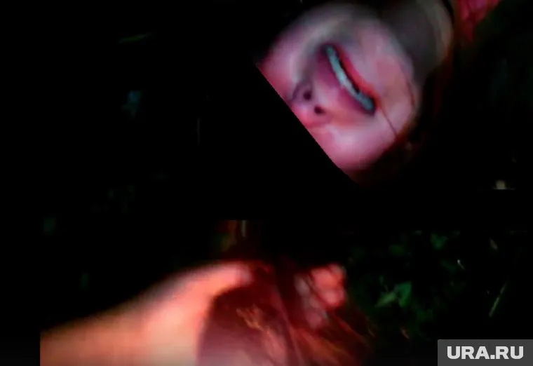 Девочку жестоко избили и подожгли ей волосы