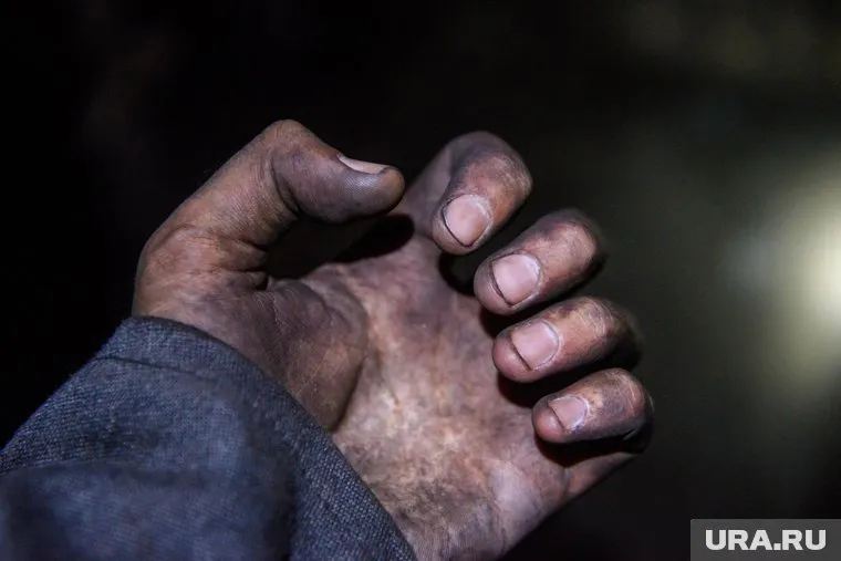 Сотрудник МБУ "Дирекция парков и скверов" в Кургане получил тяжелую травму на рабочем месте