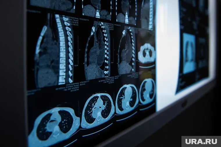 Рентген пермские медики делают на российском аппарате (архивное фото)
