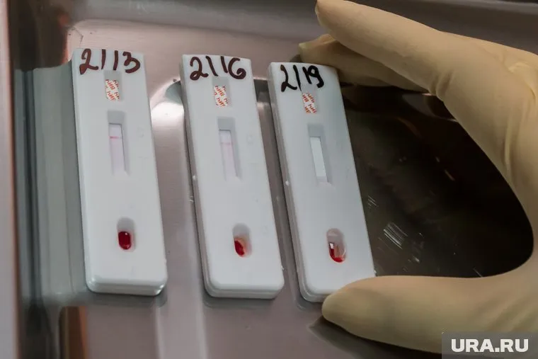 Тесты показали, что антитела лам успешно блокируют проникновение и размножение вируса