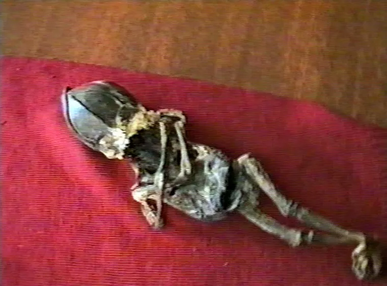 Алешенька. Кыштымский карлик , алешенька, кыштымский карлик, гуманоид, инопланетянин