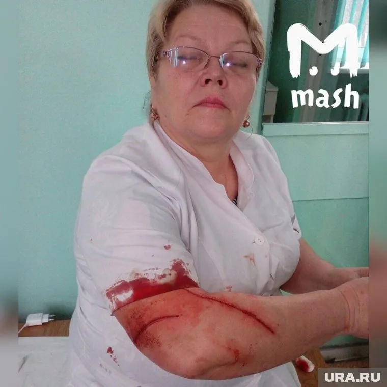 Пациентка изранила врача шариковой ручкой