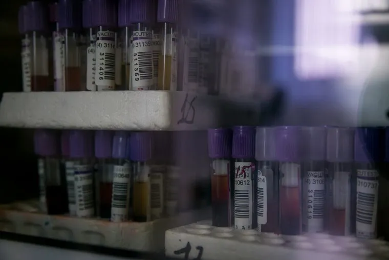 Открытие СПИД-центра. Москва, лаборатория, пробирки, спид-центр, вич, анализ крови, врачи, медперсонал, медицина, спид-тест