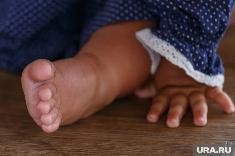 Ребенок получил около 90% ожогов тела