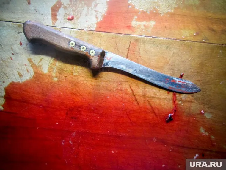 Женщина ударила его ножом в живот