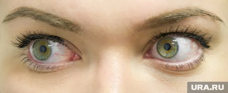 Врачи призвали защищать глаза, чтобы избежать коронавируса