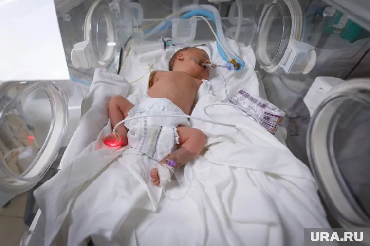 У девочки диагностировали некроз яичника, грыжу и антенатальный перекрут