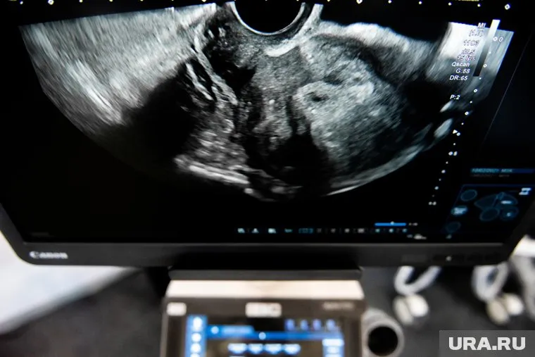 Ученые Челябинска предложили изучать сердце плода «от удара к удару»