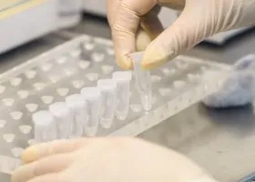 В Тюмени изучили пробы, взятые после вспышки гаффской болезни