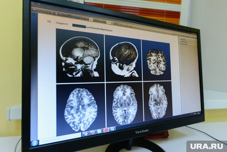 Развитие деменции в первую очередь обусловлено биологическими и генетическими факторами.