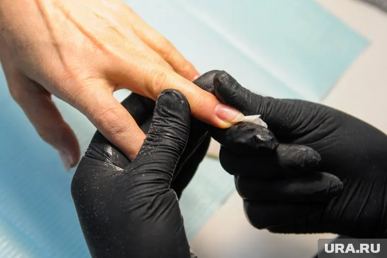 Шелушение на коже может стать следствием депрессии, считает Натэла Гришина